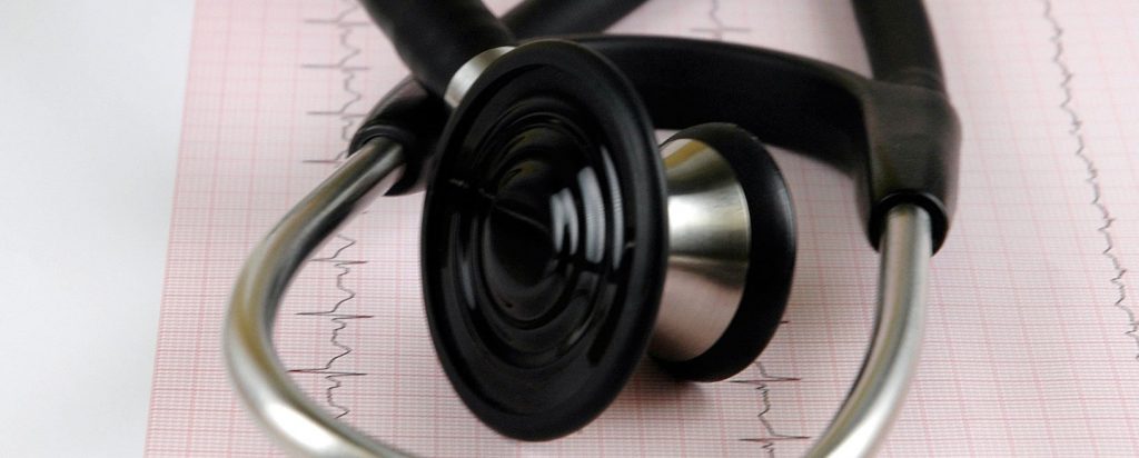 interpretación del electrocardiograma