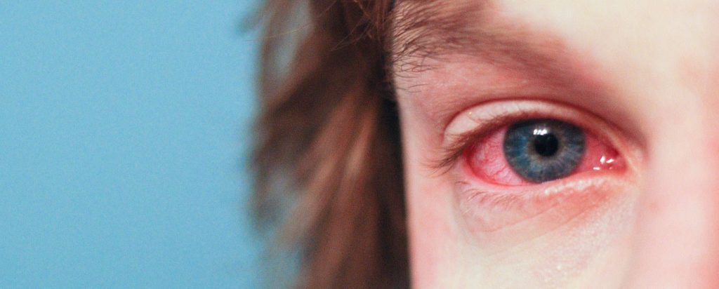 Accidentes Oculares