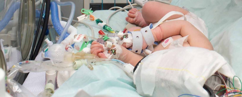 Encefalopatía Neonatal