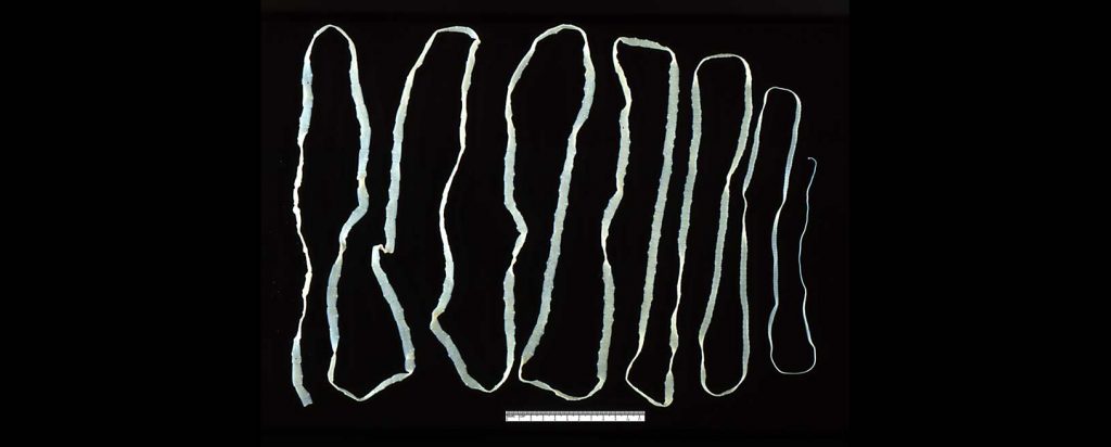 Parasitosis