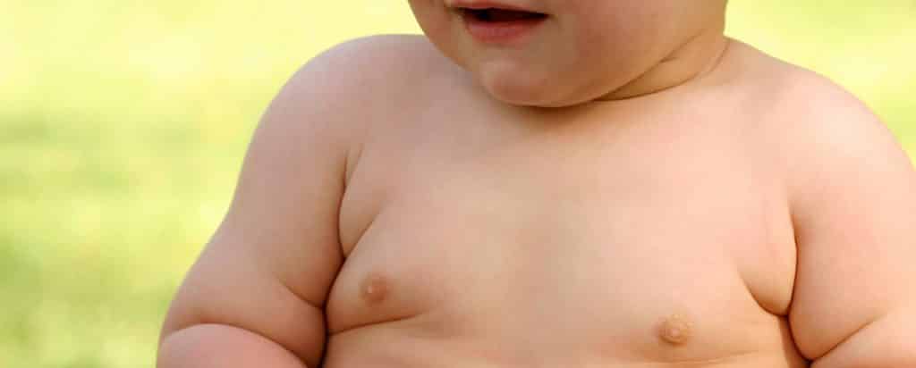 Obesidad Infantil