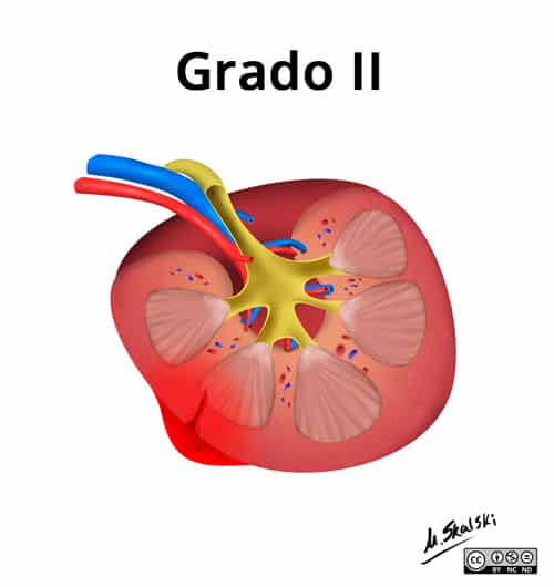 Traumatismos del aparato genitourinario