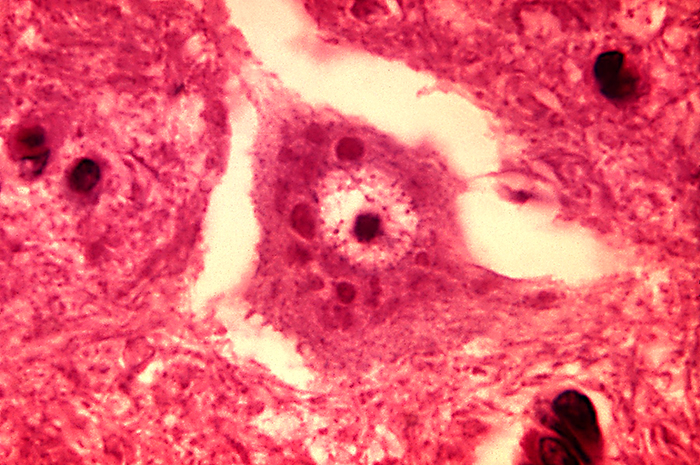 Cuerpos de Negri