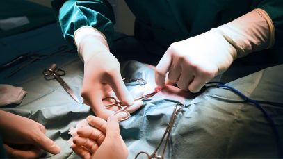 Sepsis Abdominal y Abdomen Catastrófico: Suscripción Mensual