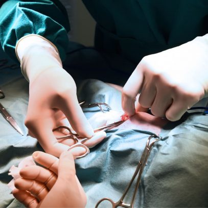 Sepsis Abdominal y Abdomen Catastrófico: Suscripción Mensual