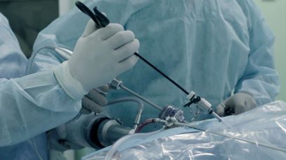 Introducción a la Cirugía Bariátrica: Diagnóstico y Tratamiento: Suscripción Mensual